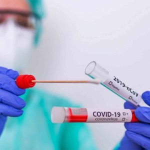 La prueba antígeno para COVID
